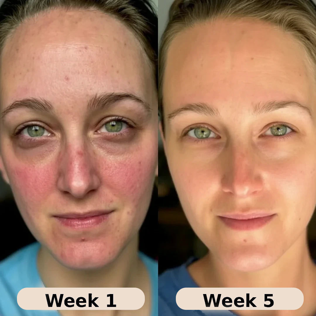 VoluFine | Korean Collagen Serum for Mature Skin