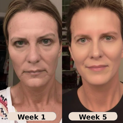 VoluFine | Korean Collagen Serum for Mature Skin